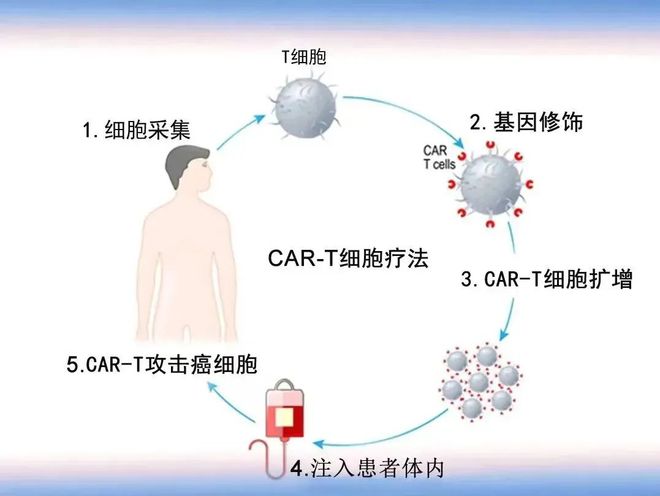 最新癌症治疗方法，突破传统，迎接希望