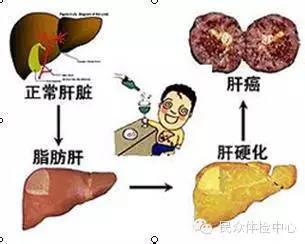 肝病的最新治疗方法